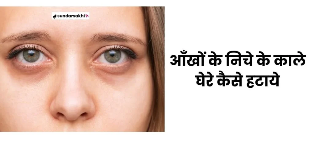 Dark Circle Kaise Hataye